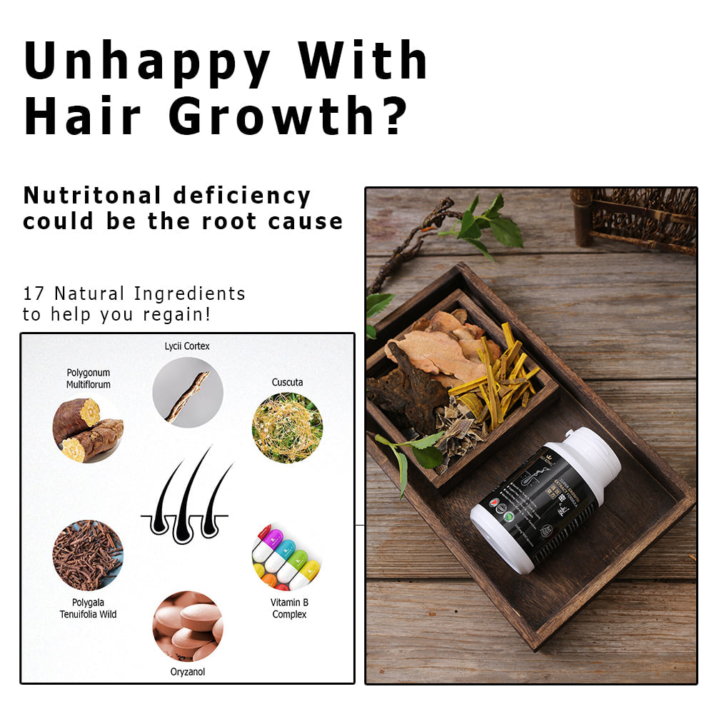[BUY 2 FREE 1] HAIR REGAINING