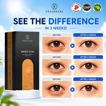 (Bundle of 3) Bright Eyes